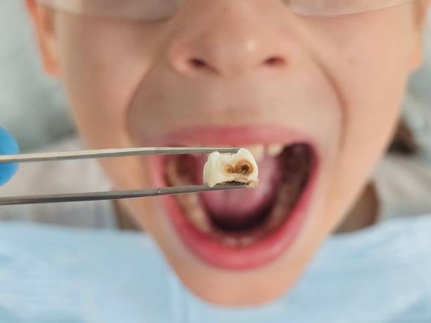 Best Emergency Treatment for Toothache in East Hemet, CA
